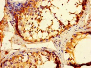 WBSCR28 Antibody