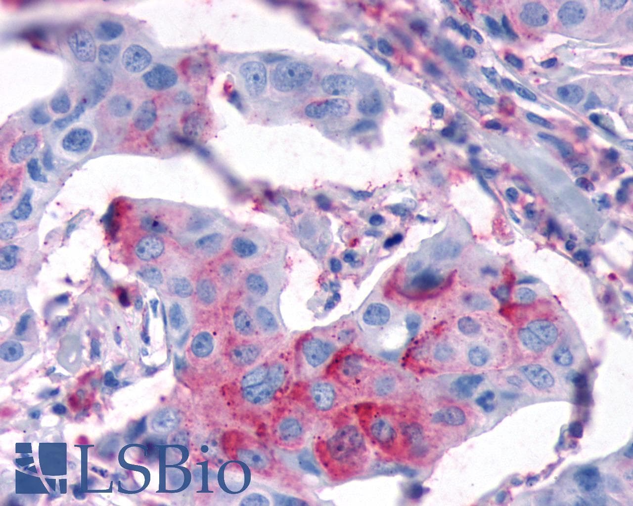 PathPlus™ Polyclonal Rabbit anti-Human FZD3 / Frizzled 3 Antibody (IHC)