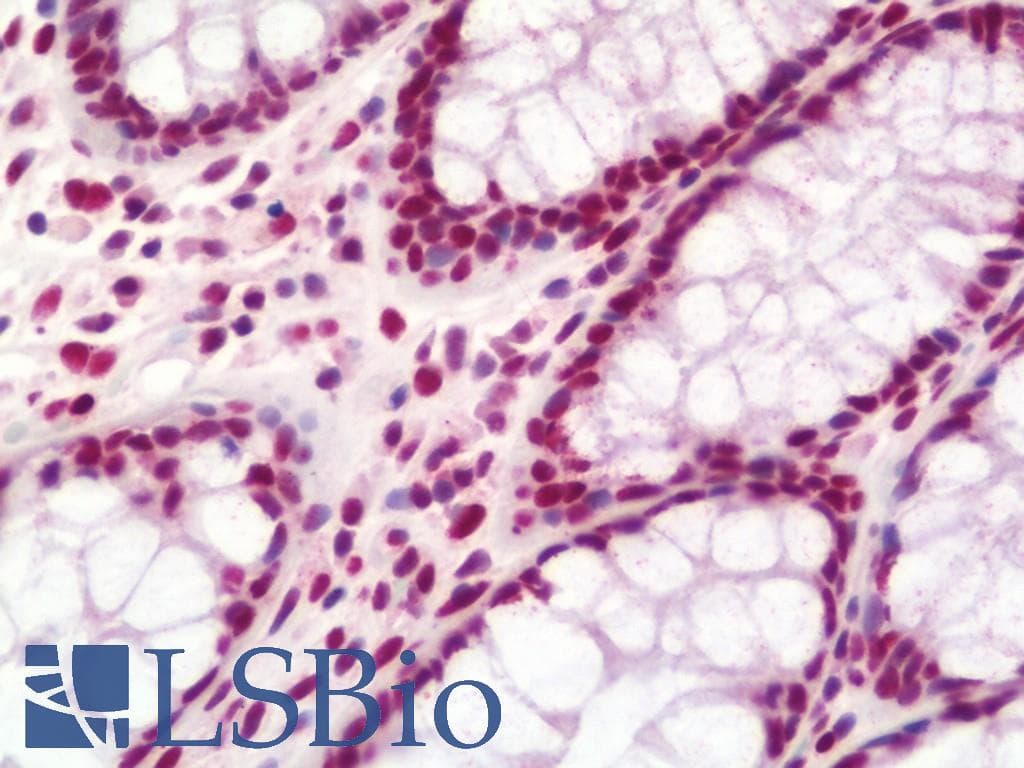 IHC-plus™ NUMA1 / NUMA Antibody (aa1-339)