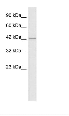 Polyclonal Rabbit anti-Human HDAC8 Antibody (C-Terminus, IHC, WB)