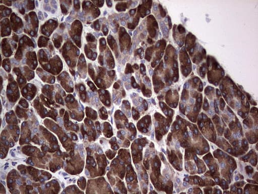 GARS / Glycyl tRNA Synthetase Antibody (clone OTI4G4)