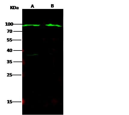 CD5 Antibody (Preservative Free)