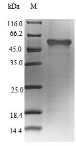 Hamster-Chinese GLUL / Glutamine Synthetase Protein (Recombinant 6His-SUMO, N-terminus)