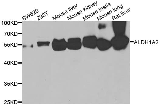 RALDH2 / ALDH1A2 Antibody