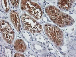 SIRT5 / Sirtuin 5 Antibody (clone OTI2A11)