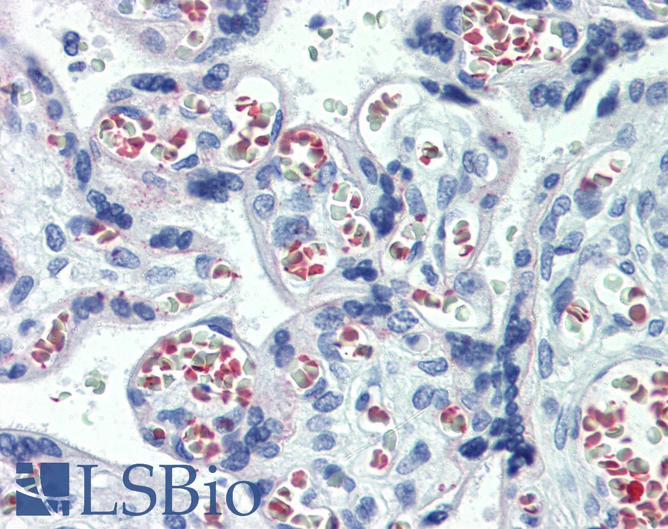 ABHD5 Antibody (C-Terminus)