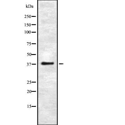 UCHL5 / UCH37 Antibody