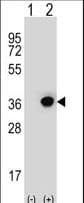 DHRS3 / SDR1 Antibody (aa85-113)