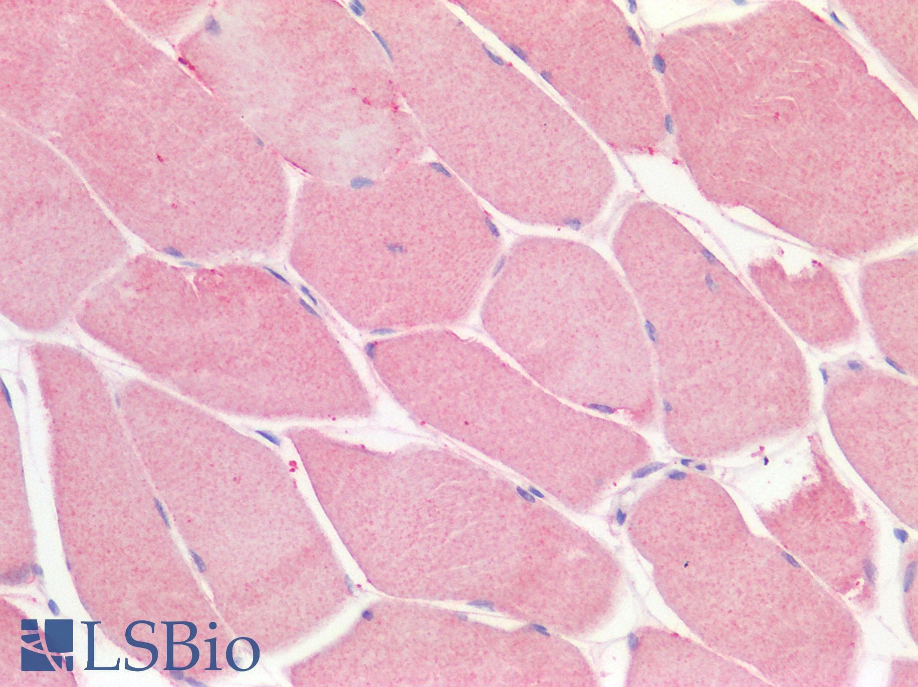 PathPlus™ Polyclonal Rabbit anti-Human GPR49 / LGR5 Antibody (Cytoplasmic Domain, IHC, IF)