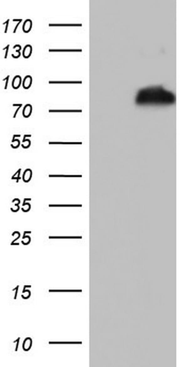 BCL6 Antibody (aa1-300, clone OTI13H4)