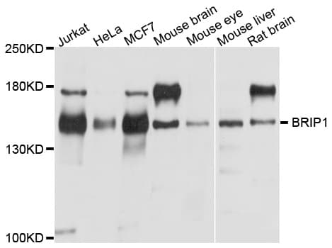 BRIP1 / BACH1 Antibody