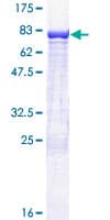 Human Yo / CDR2 Protein (Recombinant GST)