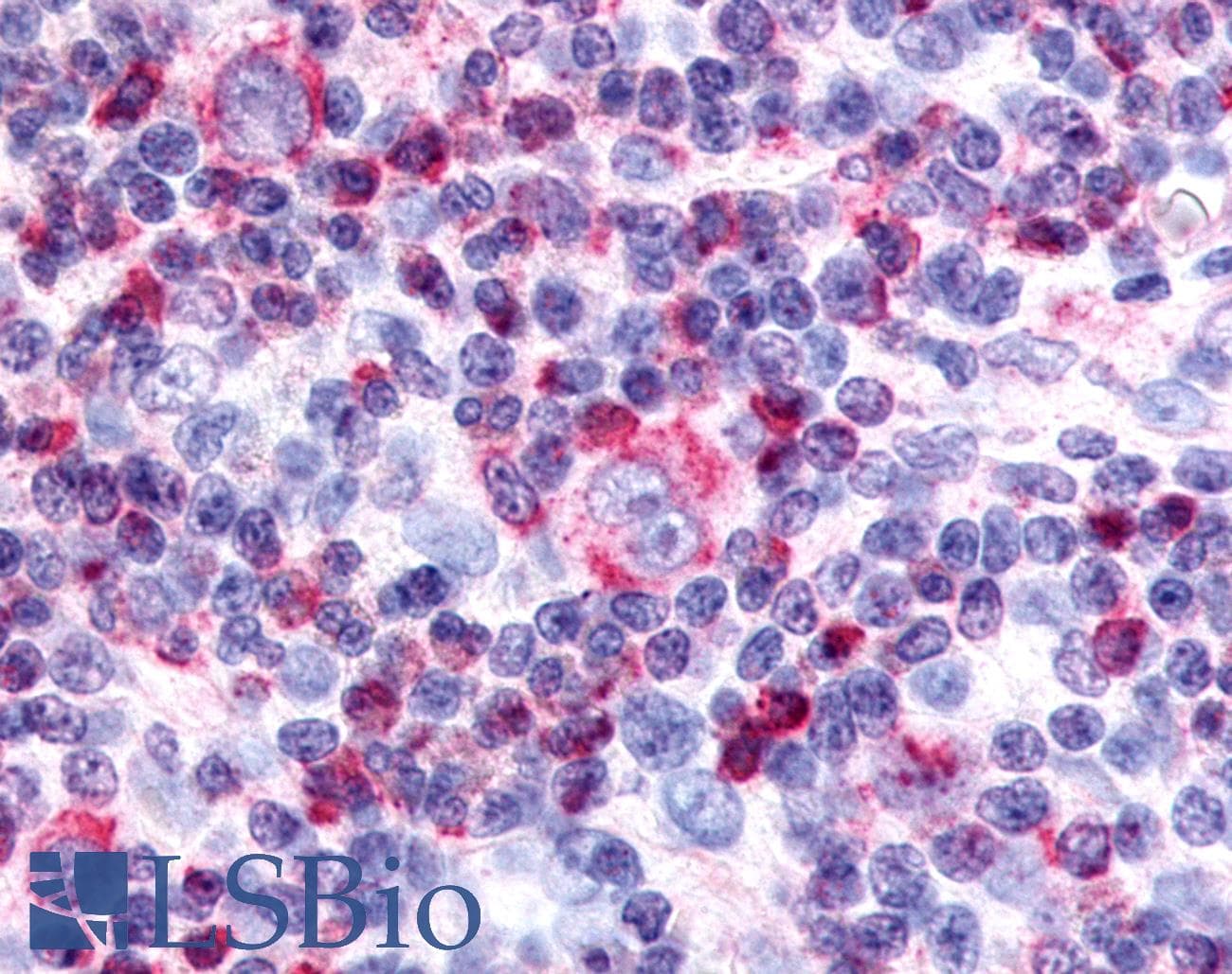 PathPlus™ Nor-1 / NR4A3 Antibody (Internal)