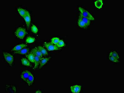Polyclonal Rabbit anti-Human MAS1L / MRG Antibody (IHC, WB)