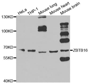 ZBTB16 / PLZF Antibody