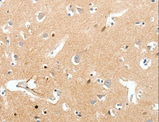 Polyclonal Rabbit anti-Human SCN9A / Nav1.7 Antibody (IHC)