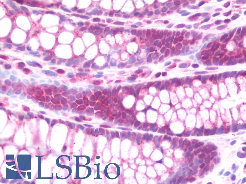 IHC-plus™ CLDN8 / Claudin 8 Antibody (aa140-166)