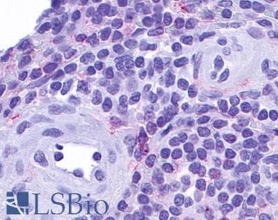 IHC-plus™ CCRL2 Antibody (Cytoplasmic Domain)
