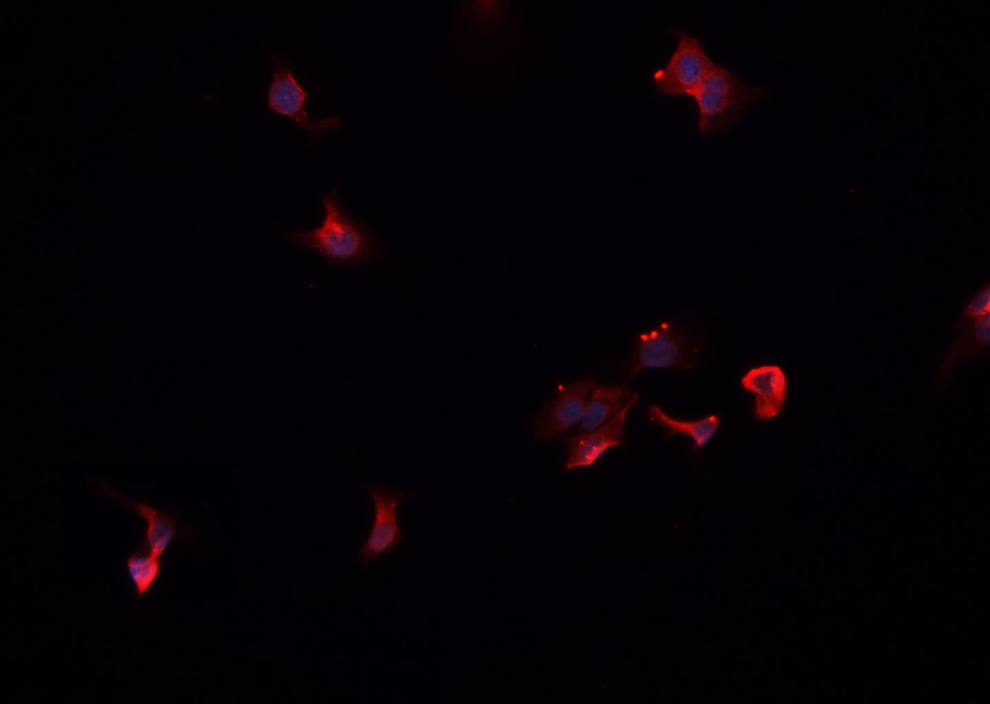 SCNN1B / ENaC Beta Antibody