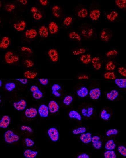 TP53 / p53 Antibody