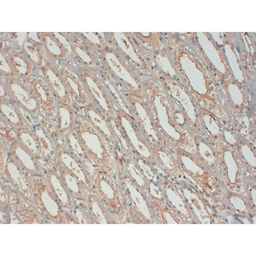 IGF1 Antibody (clone 7973)