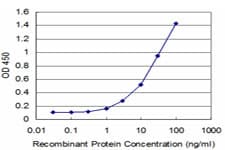 FOXF1 Antibody (clone 3D1)