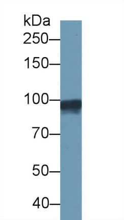 GSN / Gelsolin Antibody (aa432-553)