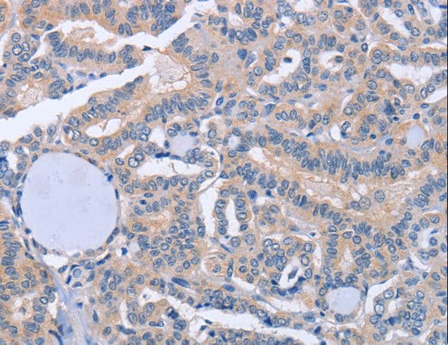 Polyclonal Rabbit anti-Human BOD1 Antibody (IHC)
