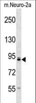 TLK1 Antibody (aa701-728)