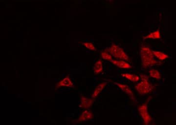 EPB41L2 Antibody