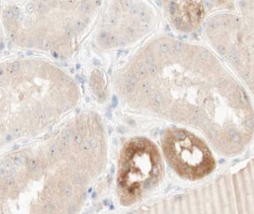 TNFAIP2 Antibody