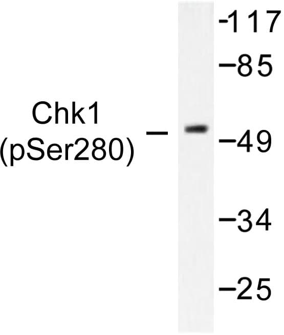 Polyclonal Rabbit anti-Human CHEK1 / CHK1 Antibody (phospho-Ser280, WB)