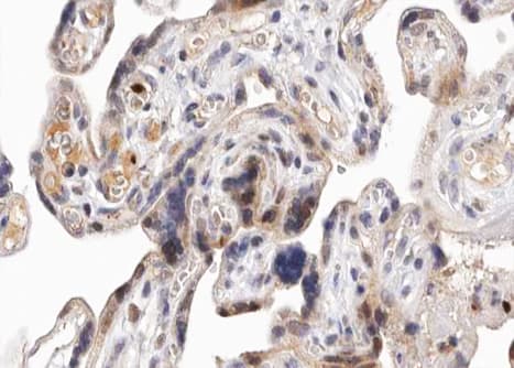 PRKD1 / PKC Mu Antibody (phospho-Ser738,pSer742)