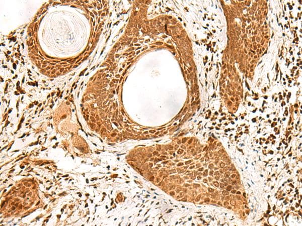 ADRM1 Antibody