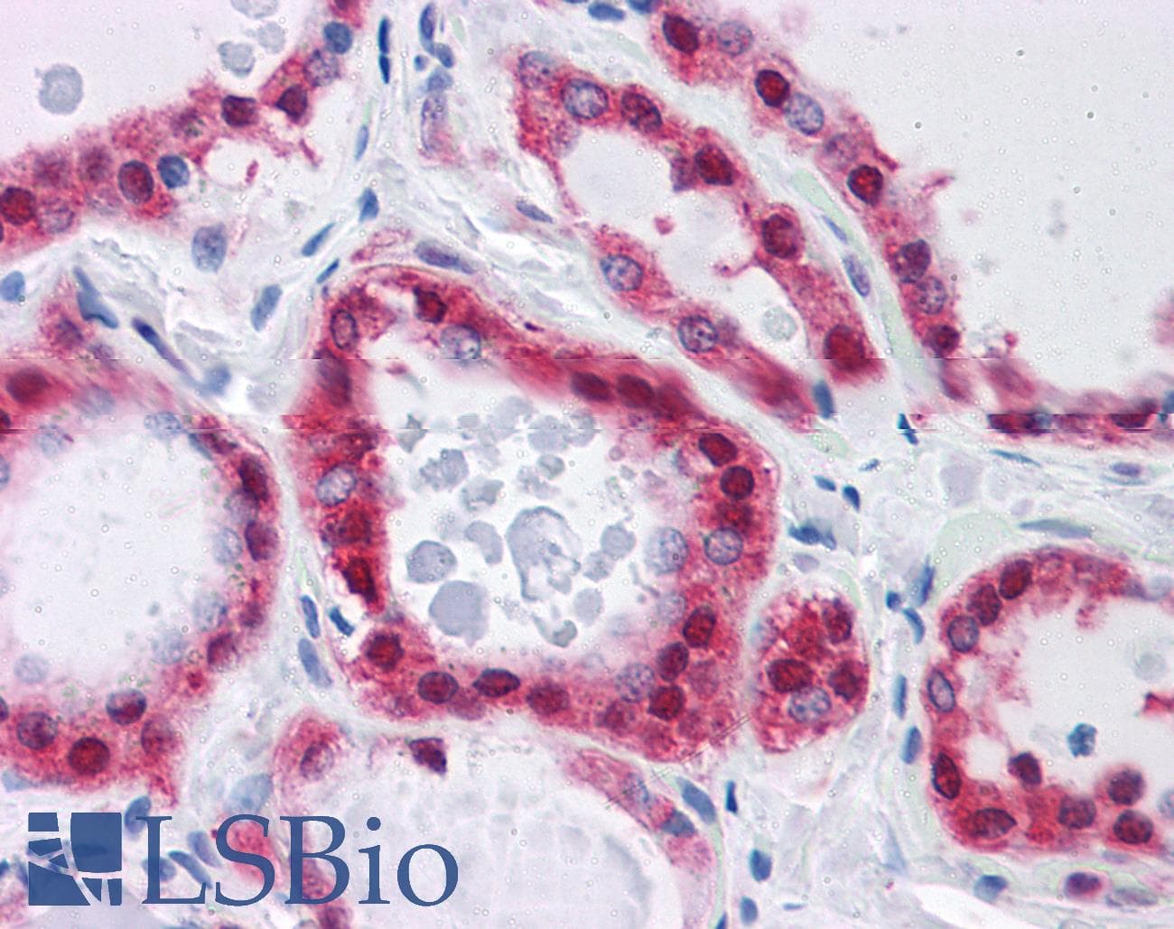 IHC-plus™ GPI Antibody (aa56-67)
