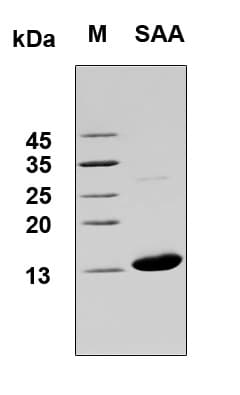 Human SAA1 / SAA / Serum Amyloid A Protein (Recombinant 6His, N-terminus)
