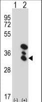 BLVRA Antibody (aa201-230)