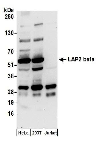 TMPO / TP / Thymopoietin Antibody (aa225-275)