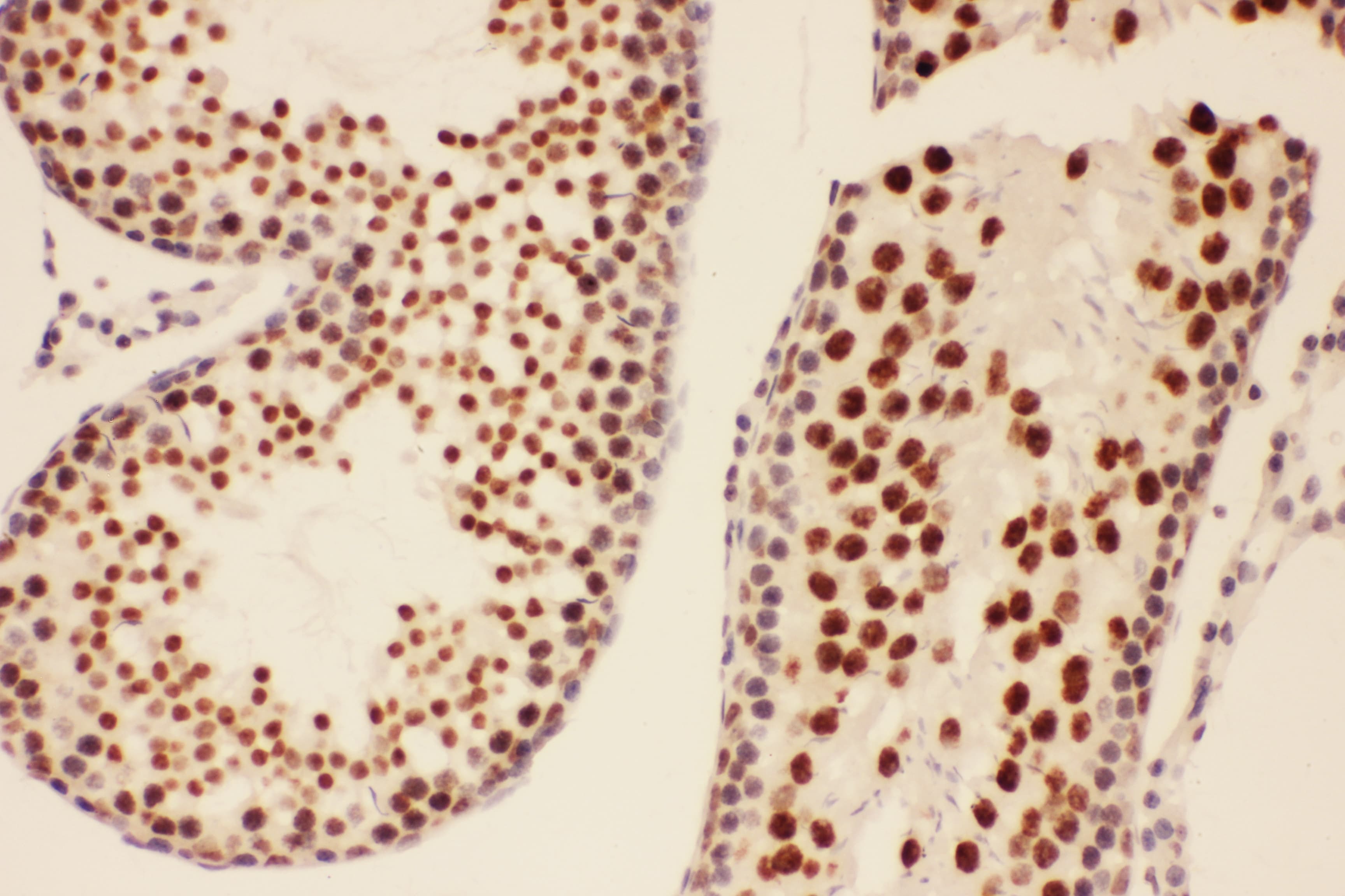 BRCA1 Antibody (aa1661-1863)