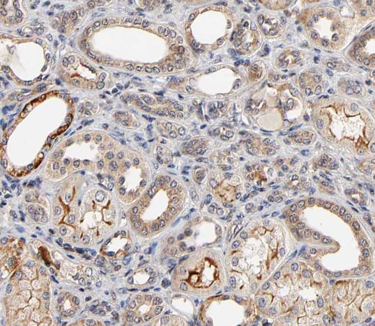 Polyclonal Rabbit anti-Human MAP3K6 / MEKK6 Antibody (IHC, IF, WB)