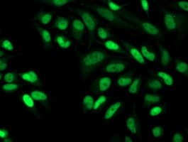 Monoclonal Mouse anti-Human CDK2 Antibody (clone OTI2D9, IHC, IF, WB)