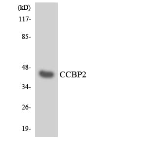 Polyclonal Rabbit anti-Human ACKR2 / CCR10 / D6 Antibody (aa334-383, WB)