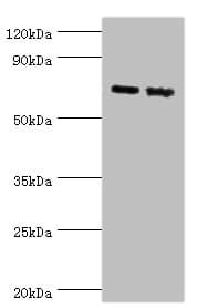 Polyclonal Rabbit anti-Human APLP1 / APLP-1 Antibody (aa39-300, WB)