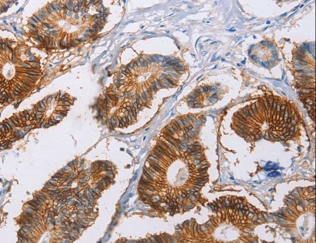 CA9 / Carbonic Anhydrase IX Antibody