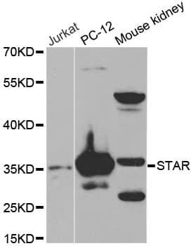 Polyclonal Rabbit anti-Human STAR Antibody (IF, WB)