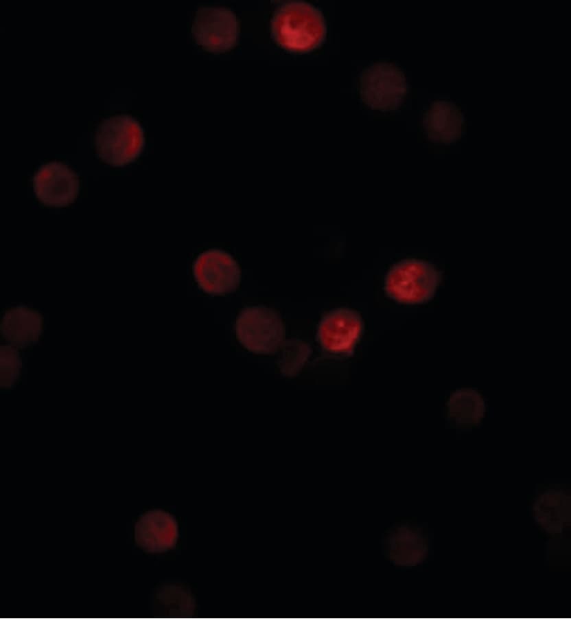 IHC-plus™ Polyclonal Rabbit anti-Human SIP1 Antibody (IHC, IF, WB)
