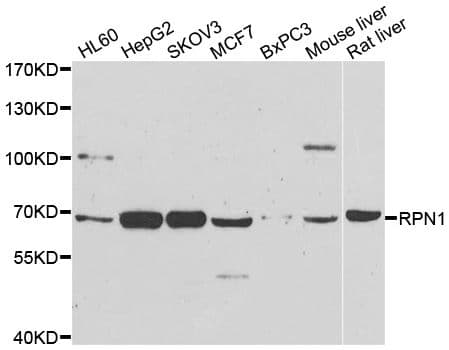 RPN1 / Ribophorin I Antibody