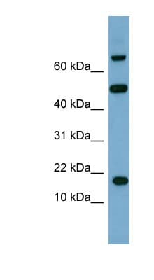 TSC22D1 / TSC22 Antibody (aa35-84)