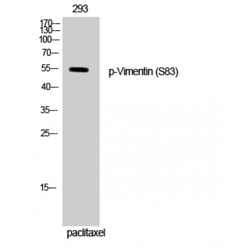 Vimentin Antibody (30-110 aa)