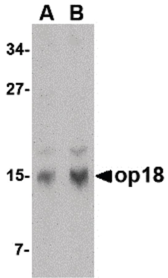 PathPlus™ STMN1 / Stathmin / LAG Antibody